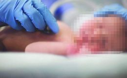 Doğumhanedeki bebeğin yüzünü gören aile, acil olarak hastaneyi terk etti